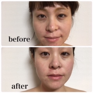 フェイシャルブログ お顔のむくみが取れると こんなに違いが出るんですよ フェイシャルブログ お顔のむくみが取れると こんなに違いが出るんですよ